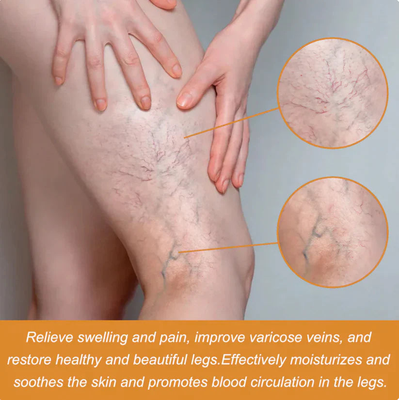 Turmeric Varicose Vein Relief Spray Buy 1 Get 1 Free