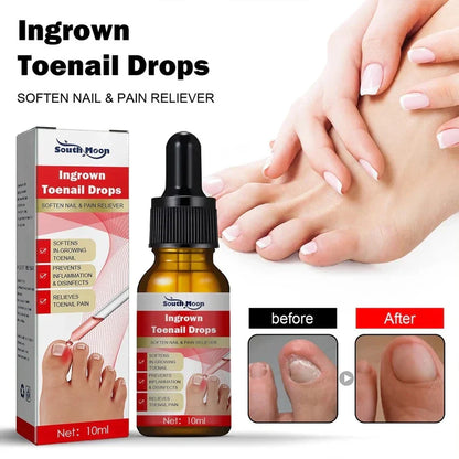 SouthMoon Ingrown Toenail Drops Nail Fungal Repair( BUY 1 GET 1 FREE)